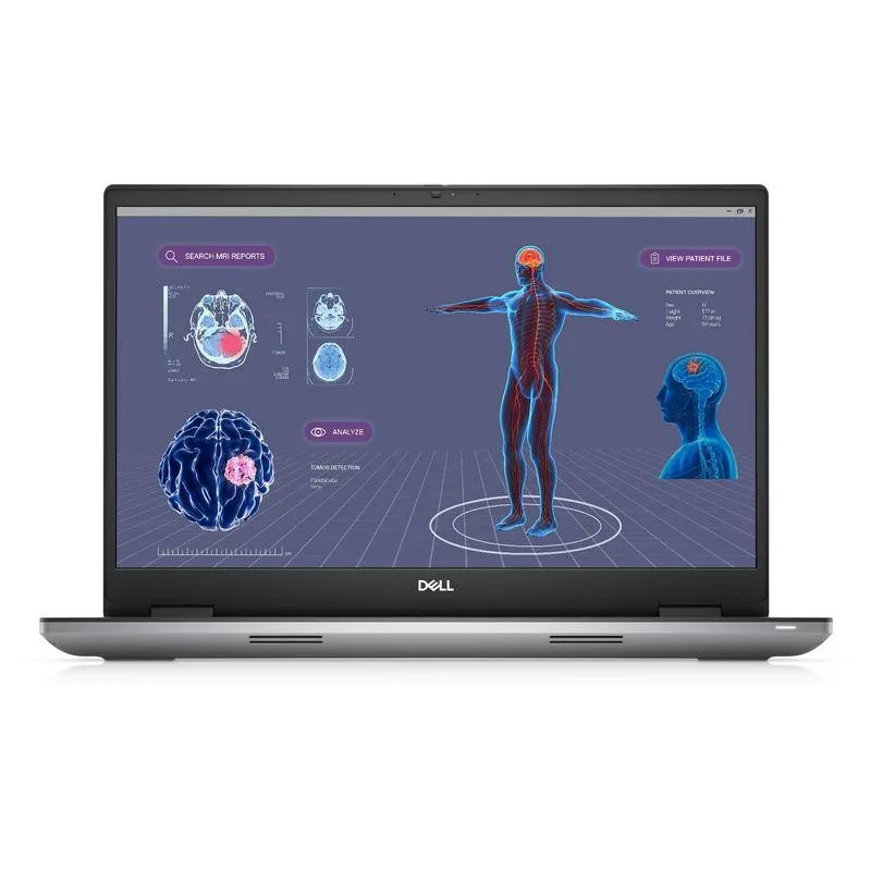 Ноутбук Dell Precision 7780 (N003P7780UHD004WP) Titan Grey